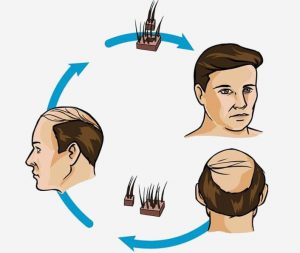 hair transplant clinic